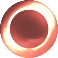 Total Eclipse